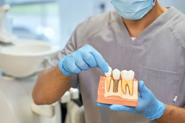 Implantologia dentale a Roma: tecnologie innovative per il tuo sorriso