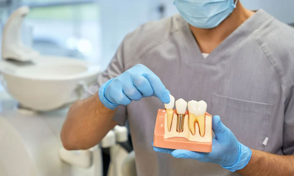 Implantologia dentale a Roma: tecnologie innovative per il tuo sorriso